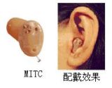 迷你耳道式助听器(MITC)